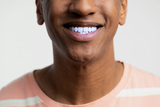 Chalky white teeth from peroxide and UV